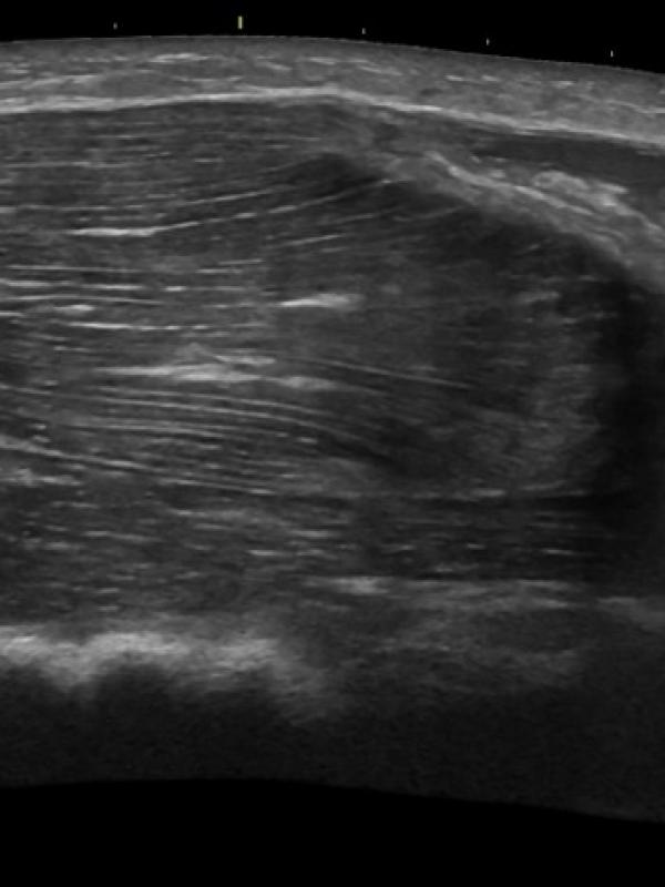 Musculoskeletal ultrasound 