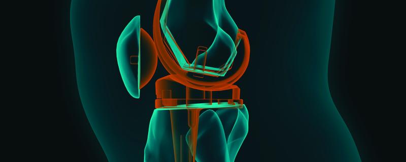 Artificial Knee Joint